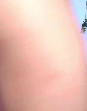 Beccakox