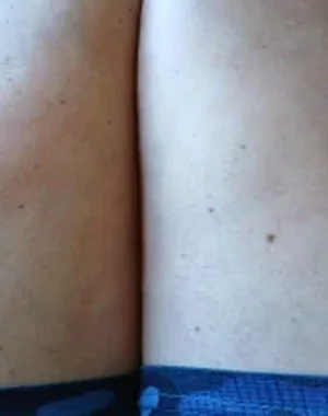 Beseb2