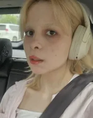 Chiekomosty